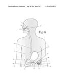 Device for Selectively Reducing Absorption of Unhealthy Food diagram and image