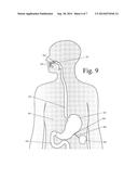 Device for Selectively Reducing Absorption of Unhealthy Food diagram and image