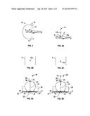 DEVICES, SYSTEMS AND METHODS FOR PLACEMENT OF INSTRUMENTS FOR MEDICAL     PROCEDURES diagram and image