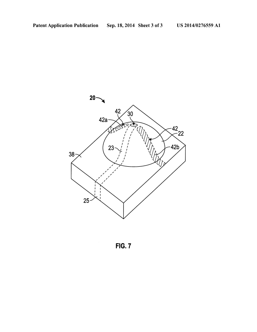 DEVICES, SYSTEMS AND METHODS FOR PLACEMENT OF INSTRUMENTS FOR MEDICAL     PROCEDURES - diagram, schematic, and image 04