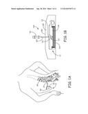 Filling Methods and Apparatus for Implanted Medical Therapy Delivery     Devices diagram and image