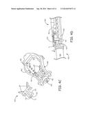 Filling Methods and Apparatus for Implanted Medical Therapy Delivery     Devices diagram and image