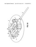 Automatic Angled Infusion Set Assembly diagram and image