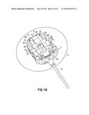 Automatic Angled Infusion Set Assembly diagram and image