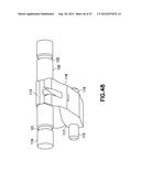 Automatic Angled Infusion Set Assembly diagram and image