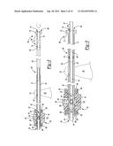 CANNULATED SYRINGE diagram and image