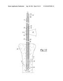 CANNULATED SYRINGE diagram and image