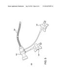 DECONSTRUCTABLE ENDOLUMINAL DEVICES AND RELATED SYSTEMS AND METHODS diagram and image