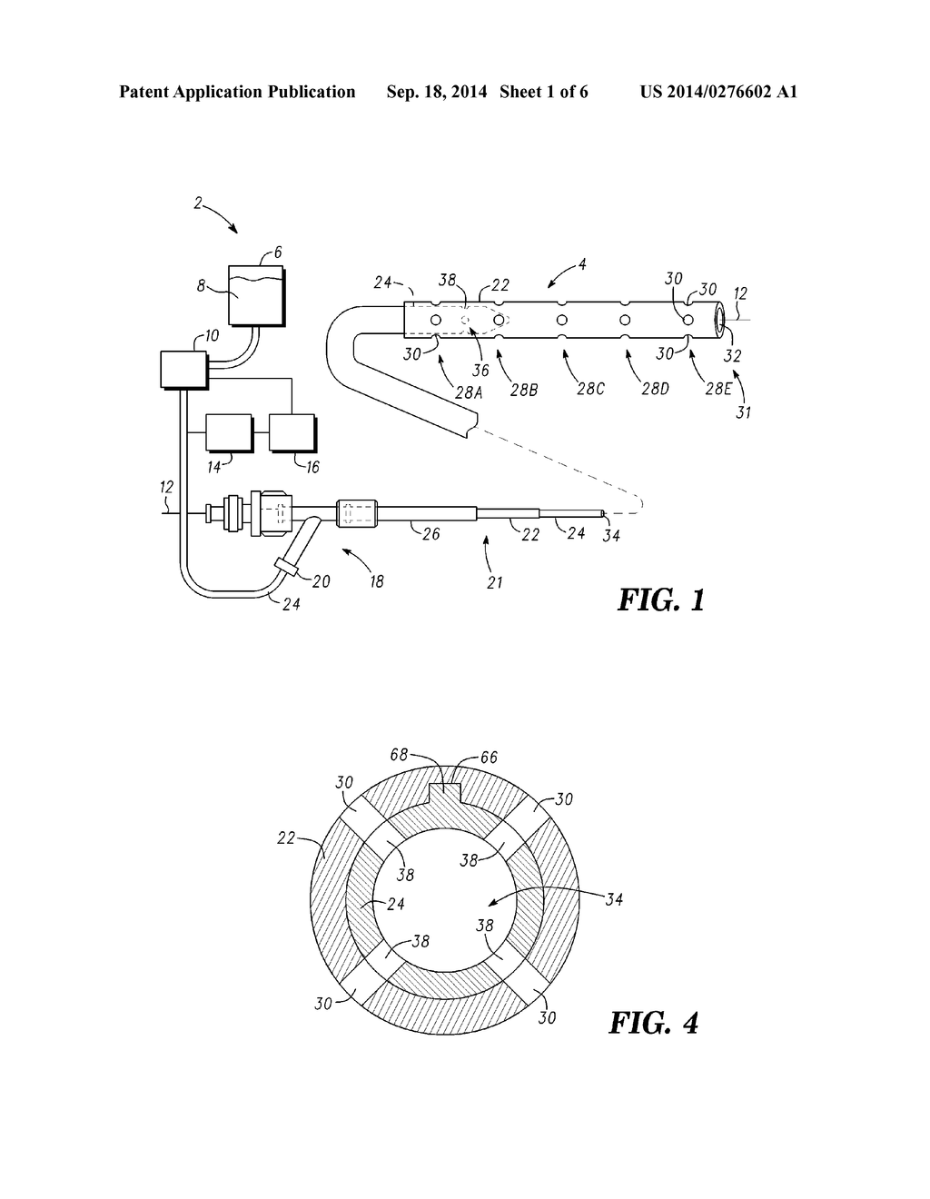 CATHETER SYSTEM - diagram, schematic, and image 02