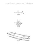 Fetal Intervention Using Magnetically-Guided Navigation diagram and image