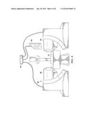 Fetal Intervention Using Magnetically-Guided Navigation diagram and image