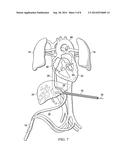 Fetal Intervention Using Magnetically-Guided Navigation diagram and image