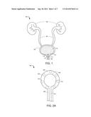 DELIVERY DEVICES AND RELATED METHODS OF USE diagram and image