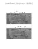 CATHETER-BASED DEVICES AND METHODS FOR IDENTIFYING SPECIFIC ANATOMICAL     LANDMARKS OF THE HUMAN AORTIC VALVE diagram and image