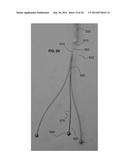 CATHETER-BASED DEVICES AND METHODS FOR IDENTIFYING SPECIFIC ANATOMICAL     LANDMARKS OF THE HUMAN AORTIC VALVE diagram and image