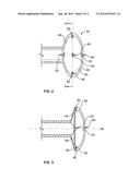 TRANSANAL IRRIGATION KIT diagram and image