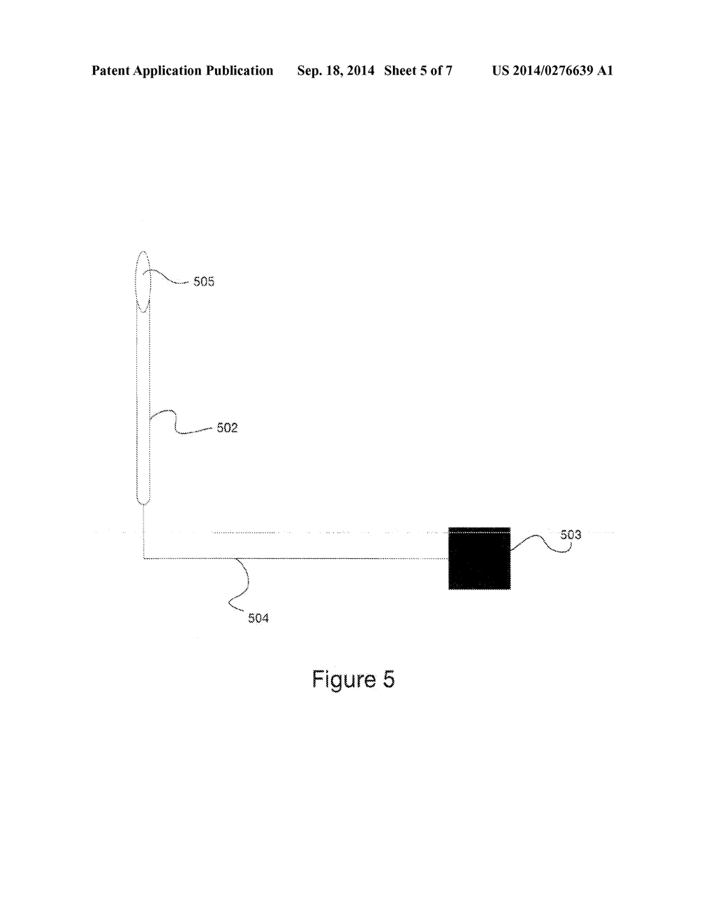 SYSTEM AND METHOD FOR PROVIDING PRESSURIZED INFUSION - diagram, schematic, and image 06