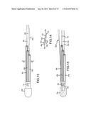 TRI-CURVE ELONGATE MEDICAL DEVICE diagram and image