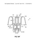 Connection System for Medical Device Components diagram and image