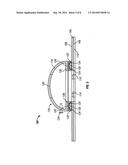 APPARATUS FOR PROVIDING FIXATION OF A LINE TO A SUBJECT diagram and image