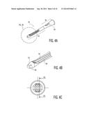 Clean Intermittent Catheter Having External Flow Paths diagram and image