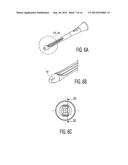 Clean Intermittent Catheter Having External Flow Paths diagram and image