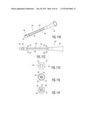 Clean Intermittent Catheter Having External Flow Paths diagram and image