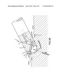 Pressure Sensing of Irrigant Backpressure for Aligning Directional Medical     Devices with Target Tissue diagram and image