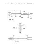 Therapeutic Cryoablation System diagram and image