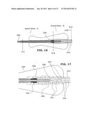 Therapeutic Cryoablation System diagram and image