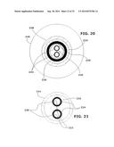 Therapeutic Cryoablation System diagram and image