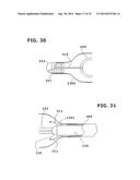 Therapeutic Cryoablation System diagram and image