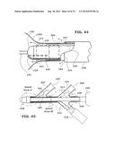 Therapeutic Cryoablation System diagram and image