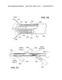 Therapeutic Cryoablation System diagram and image