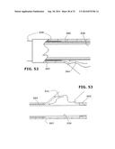 Therapeutic Cryoablation System diagram and image