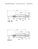 Therapeutic Cryoablation System diagram and image