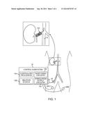 SYSTEM AND METHOD OF USING EVOKED COMPOUND ACTION POTENTIALS TO MINIMIZE     VESSEL TRAUMA DURING NERVE ABLATION diagram and image