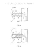 Direct Heat Ablation Catheter diagram and image