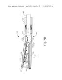 Tissue Clamping Features of Surgical Instrument End Effector diagram and image