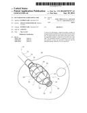 RF ENABLED INFLATABLE BONE TAMP diagram and image