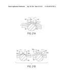 SURGICAL INSTRUMENT WITH MULTIPLE CLAMPING MECHANISMS diagram and image