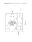 MICROWAVE ENERGY-DELIVERY DEVICE AND SYSTEM diagram and image