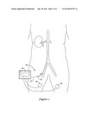 MEDICAL SYSTEMS AND METHODS FOR MODULATING NERVES diagram and image