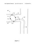 MEDICAL SYSTEMS AND METHODS FOR MODULATING NERVES diagram and image