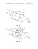 WALL-SPARING RENAL NERVE ABLATION CATHETER WITH SPACED ELECTRODE     STRUCTURES diagram and image