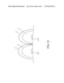 METHODS AND APPARATUSES FOR REMODELING TISSUE OF OR ADJACENT TO A BODY     PASSAGE diagram and image