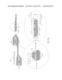 METHODS AND APPARATUSES FOR REMODELING TISSUE OF OR ADJACENT TO A BODY     PASSAGE diagram and image