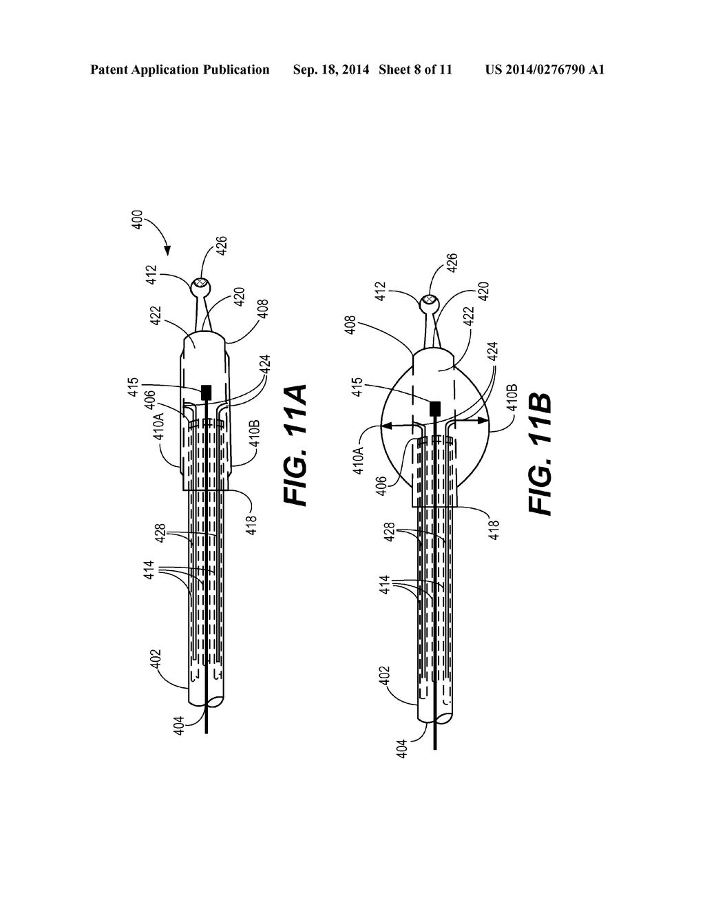 DEVICES FOR TISSUE SEPARATION AND RELATED METHODS OF USE - diagram, schematic, and image 09