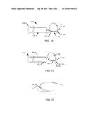 DEVICES FOR TISSUE RESECTION diagram and image