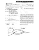 TISSUE RESECTION DEVICE AND RELATED METHODS OF USE diagram and image